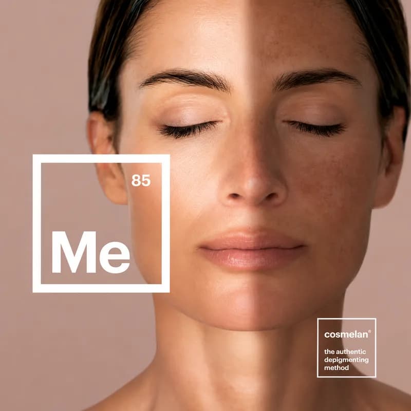 Cosmelan, protocole dépigmentant Mesoestetic proposé chez Luxury Glow
